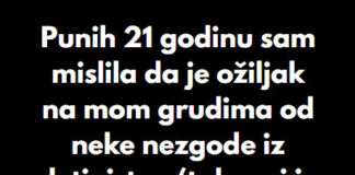 “Punih 21 godinu sam mislila da je ožiljak na mom grudima od neke nezgode iz detinjstva…” “Punih 21 godinu sam mislila da je ožiljak na mom grudima od neke nezgode iz detinjstva…” - featured image