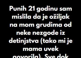 “Punih 21 godinu sam mislila da je ožiljak na mom grudima od neke nezgode iz detinjstva…” “Punih 21 godinu sam mislila da je ožiljak na mom grudima od neke nezgode iz detinjstva…” - featured image