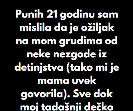 “Punih 21 godinu sam mislila da je ožiljak na mom grudima od neke nezgode iz detinjstva…” “Punih 21 godinu sam mislila da je ožiljak na mom grudima od neke nezgode iz detinjstva…” - featured image